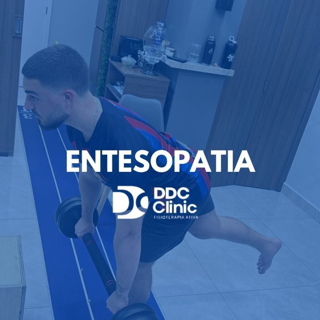 Entesopatia