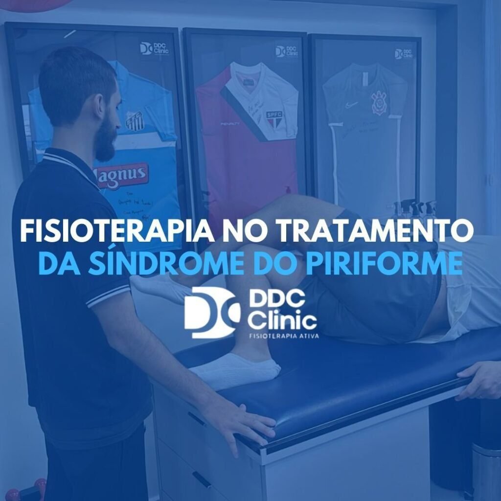 Síndrome do Piriforme